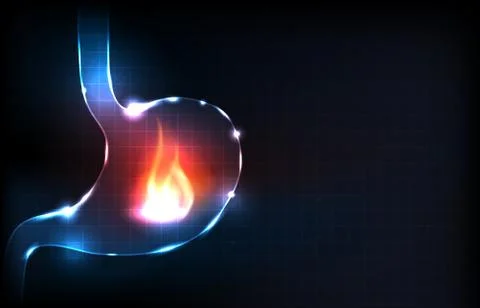 Human stomach burn Illustrazione stock