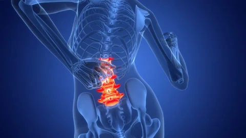 Human Suffering with Severe Back Pain Anatomy Animation Concept Stock Footage 307416596