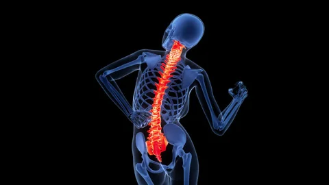 Human Suffering with Severe Back Pain Anatomy Animation Concept Stock Footage 340010537