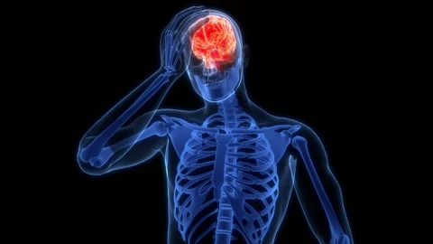 Human Suffering with Severe Headache Anatomy Animation Concept Stock Footage 303623484