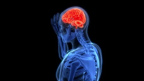 Human Suffering with Severe Headache Anatomy Animation Concept 스톡 동영상 303623722