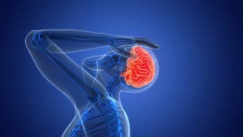 Human Suffering with Severe Headache Anatomy Animation Concept Stock Footage 307391972