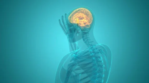 Human Suffering with Severe Headache Anatomy Animation Concept Stock Footage 307403782