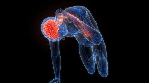 Human Suffering with Severe Headache Anatomy Animation Concept Vídeos de archivo 307403923