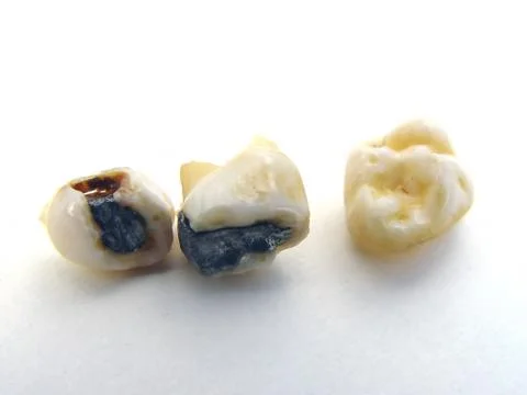Human teeth Stock Photos
