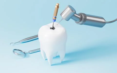 Human teeth root canal treatment process. 3d rendering. 스톡 일러스트