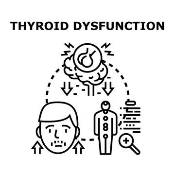 Human thyroid dysfunction condition causing health problems illustration Stock Illustration