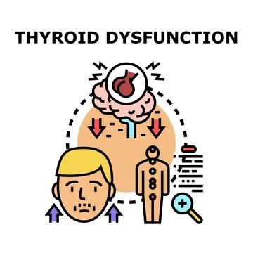 Human thyroid dysfunction condition causing health problems illustration Stock Illustration