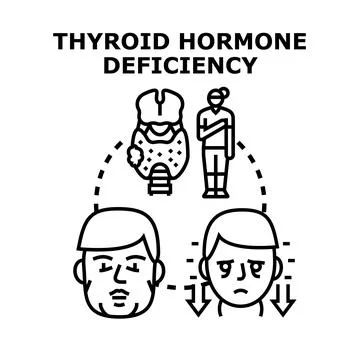 Human thyroid hormone deficiency causing health problems Stock Illustration