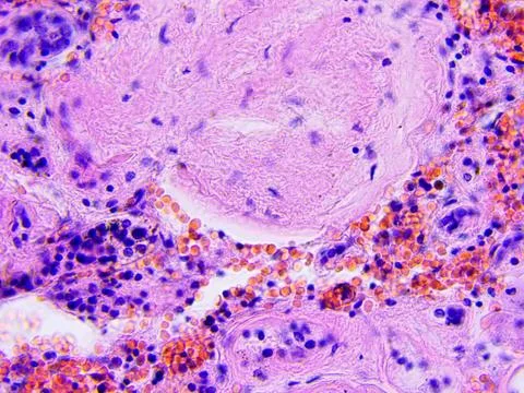 Human tissue microscopic photography Stock Photos
