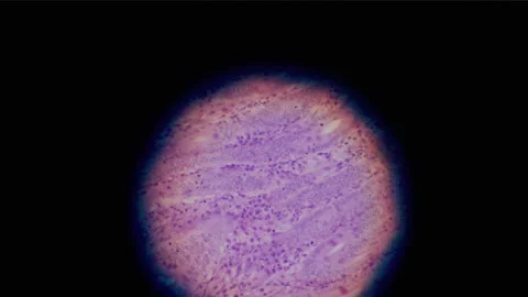 Human tissue shot through the lens of a microscope 스톡 동영상 232008047