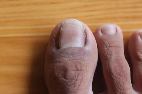 Human toe 写真素材