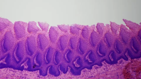 Human tongue under a microscope. Study o... | Stock Video | Pond5