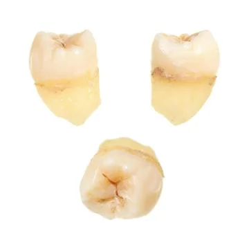 Human tooth Stock Photos