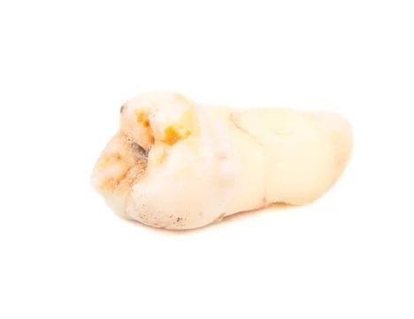 Human tooth Stock Photos