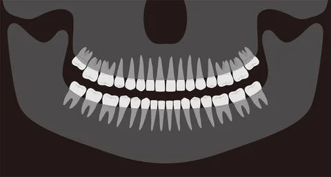 Human X-ray picture of teeth, vector illustration Stock Illustration