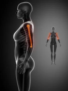 HUMERUS black x--ray bone scan Stock Illustration