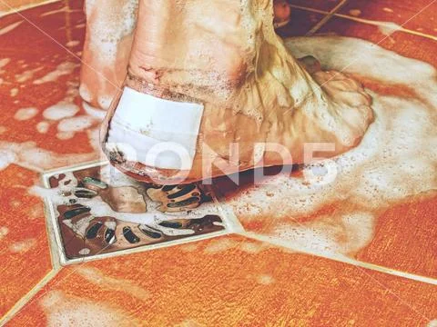 Hurt foott with white patch on heel. Wet feet Stock Photos