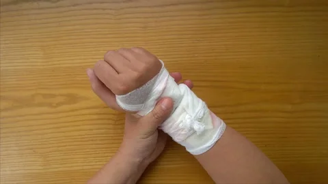 Hurt handhurt hand doing physiotherapy Stock Footage 97730125