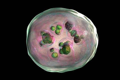 Hydatid cyst of Echinococcus granulosus Stock Illustration