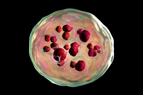 Hydatid cyst of Echinococcus granulosus Illustrazione stock