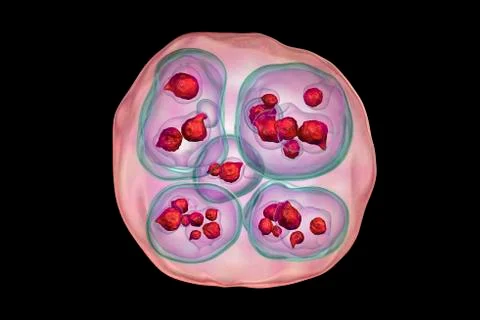 Hydatid cyst of Echinococcus multilocularis Illustrazione stock