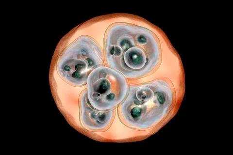 Hydatid cyst of Echinococcus multilocularis Illustrazione stock