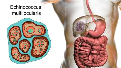 Hydatid cyst of Echinococcus multilocularis 스톡 일러스트