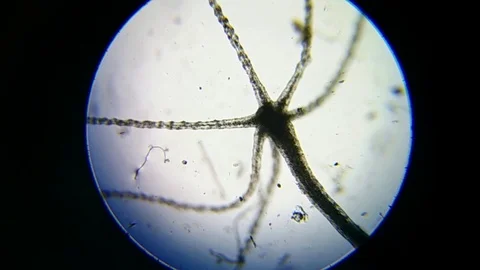 Hydra polyp in a drop of water Stock Footage 107232888
