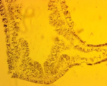 Hydra sp. longitudinal slit - permanent slide plate under high magnification Stock Photos