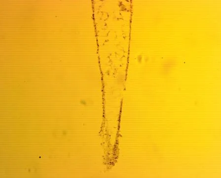 Hydra sp. longitudinal slit - permanent slide plate under high magnification Foto stock