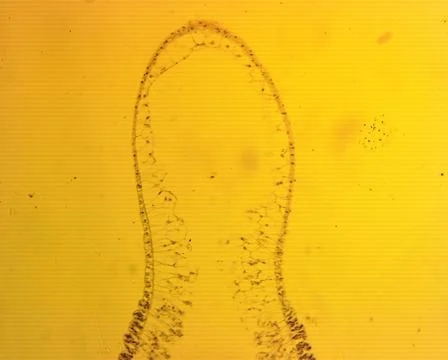 Hydra sp. longitudinal slit - permanent slide plate under high magnification Fotos de archivo