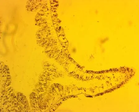 Hydra sp. longitudinal slit - permanent slide plate under high magnification Stock Photos