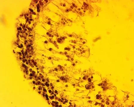 Hydra sp. transverse slit - permanent slide plate under high magnification Stock-Fotos