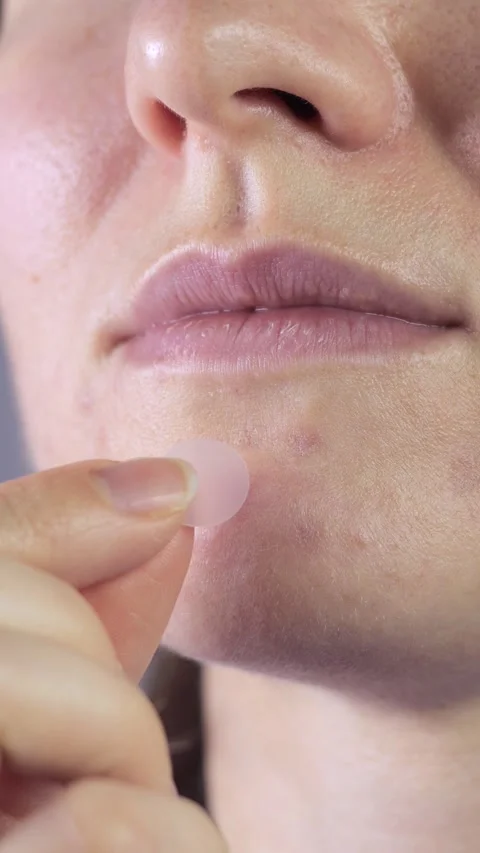 Hydrocolloid Stock Footage 308390212