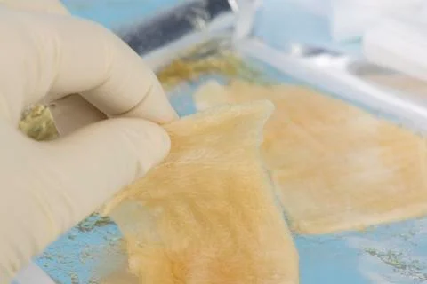 Hydrogel Burn Dressing Stock Photos