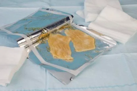 Hydrogel Burn Dressing Foto stock