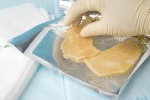 Hydrogel Burn Dressing Stock Photos