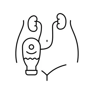 Hydronephrosis urology line icon vector illustration Stockillustratie