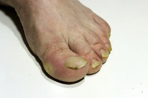 Hygiene Stock Photos