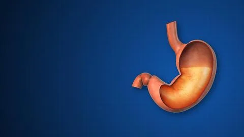 Hyper Acid present in Stomach Stockillustratie