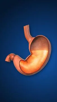 Hyper Acid present in Stomach 스톡 일러스트