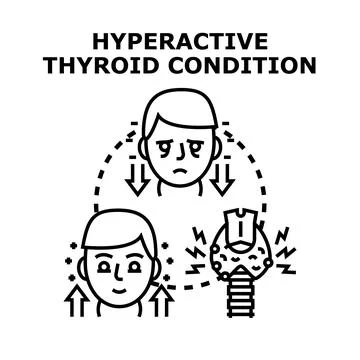 Hyperactive thyroid condition causing health problems illustration Stock Illustration