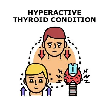 Hyperactive thyroid condition causing health problems illustration Stock Illustration