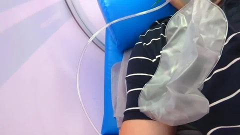 A Hyperbaric Oxygen Chamber Bag Stock Footage 323396810