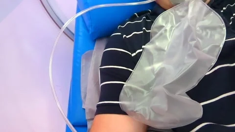 A Hyperbaric Oxygen Chamber Bag Stock Footage 323396815