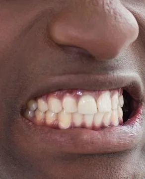Hyperrealistic 3D render is showing lower face with open lips exposing teeth and Stock Photos