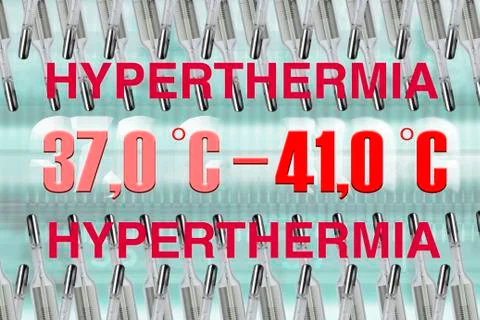 Hyperthermia Stock Illustration