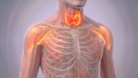 Hyperthyroidism and enlarged thyroid gland visualized in human body Stock Footage 346240747