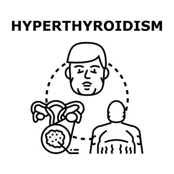 Hyperthyroidism health problem affecting human body, symptoms Stock Illustration